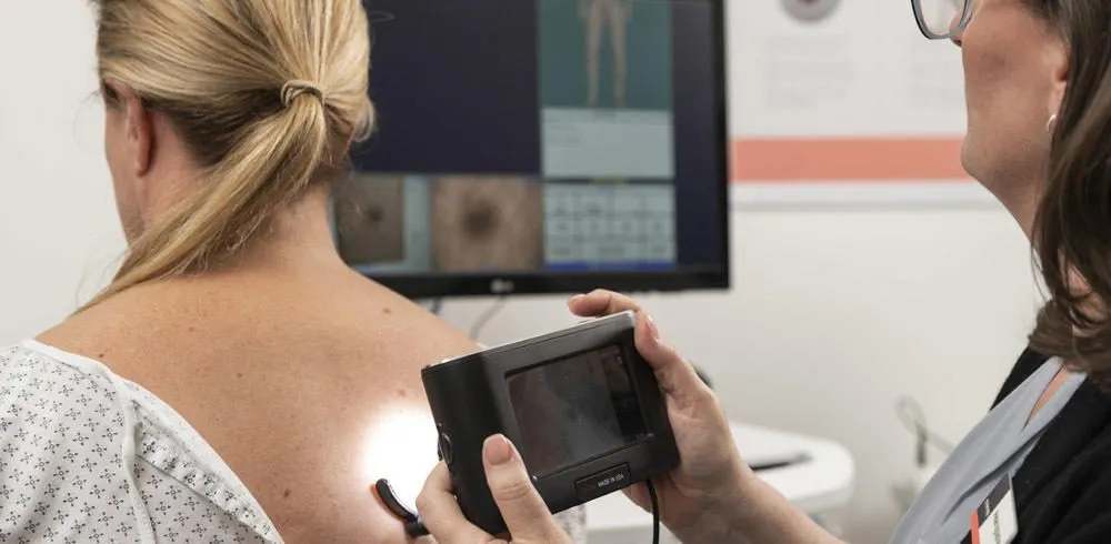 What is mole mapping