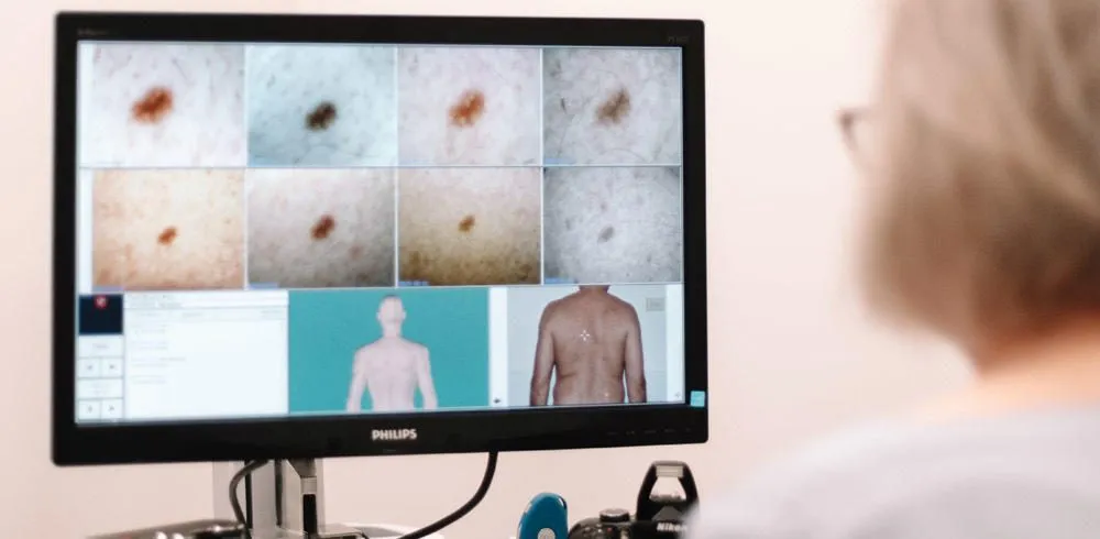 Whats the difference between a skin check and mole mapping