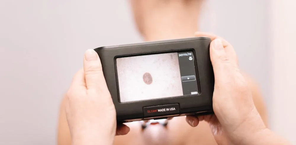 Why full body mole mapping costs more than a skin check