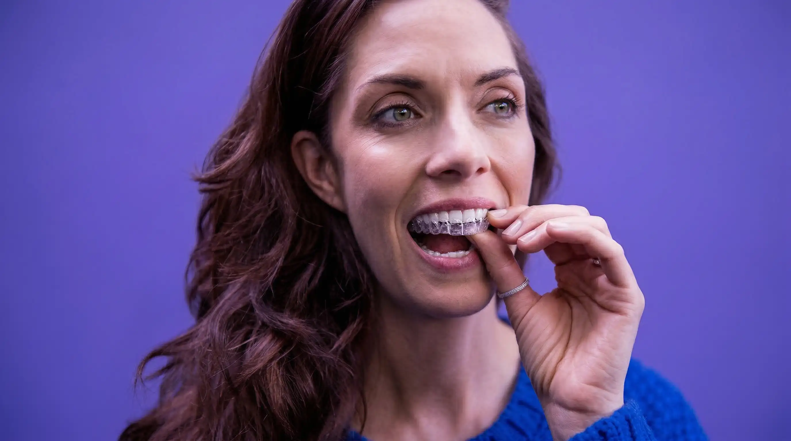 Invisalign Ergebnis