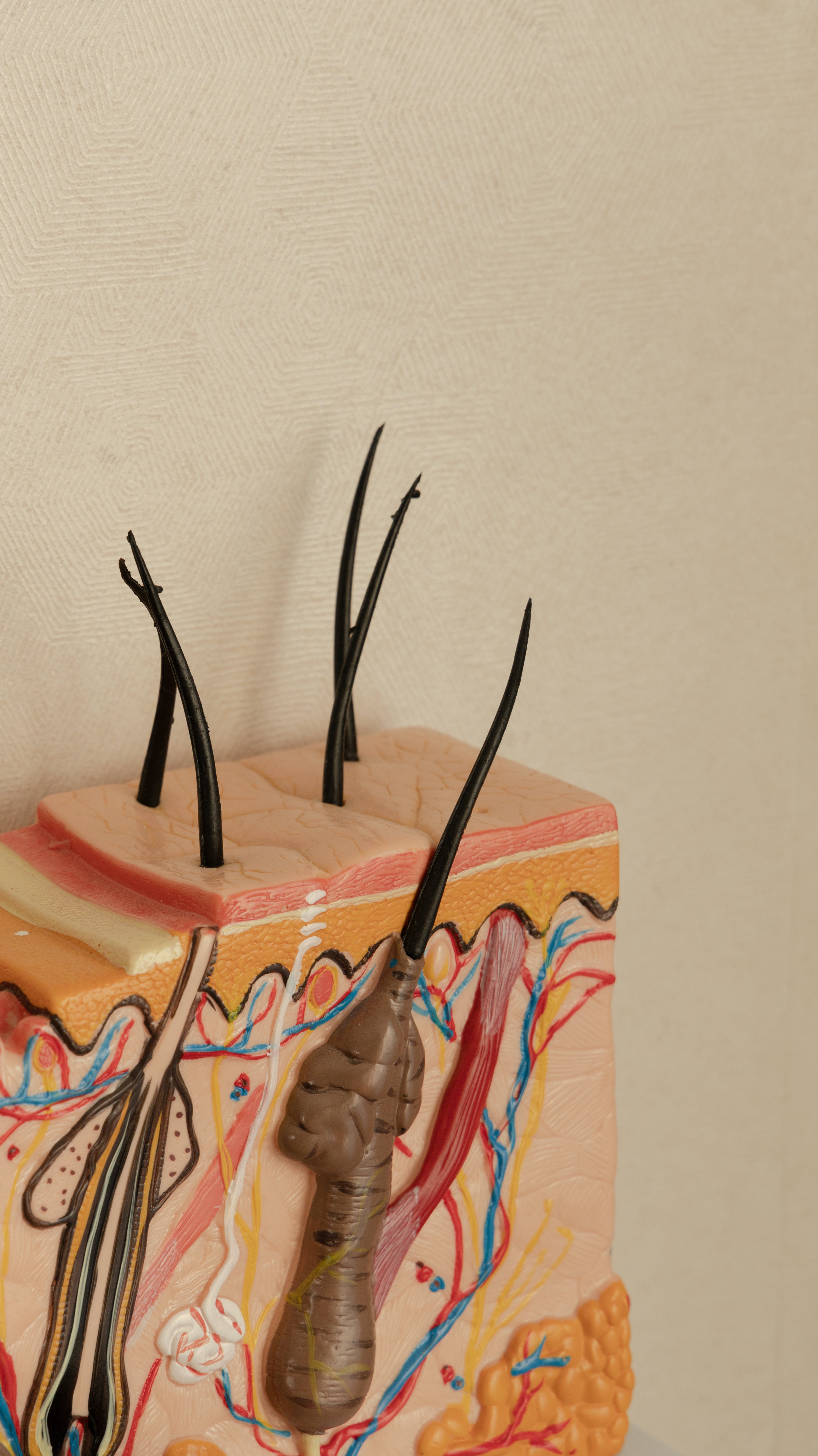 Can Lyme Disease Cause Autism?