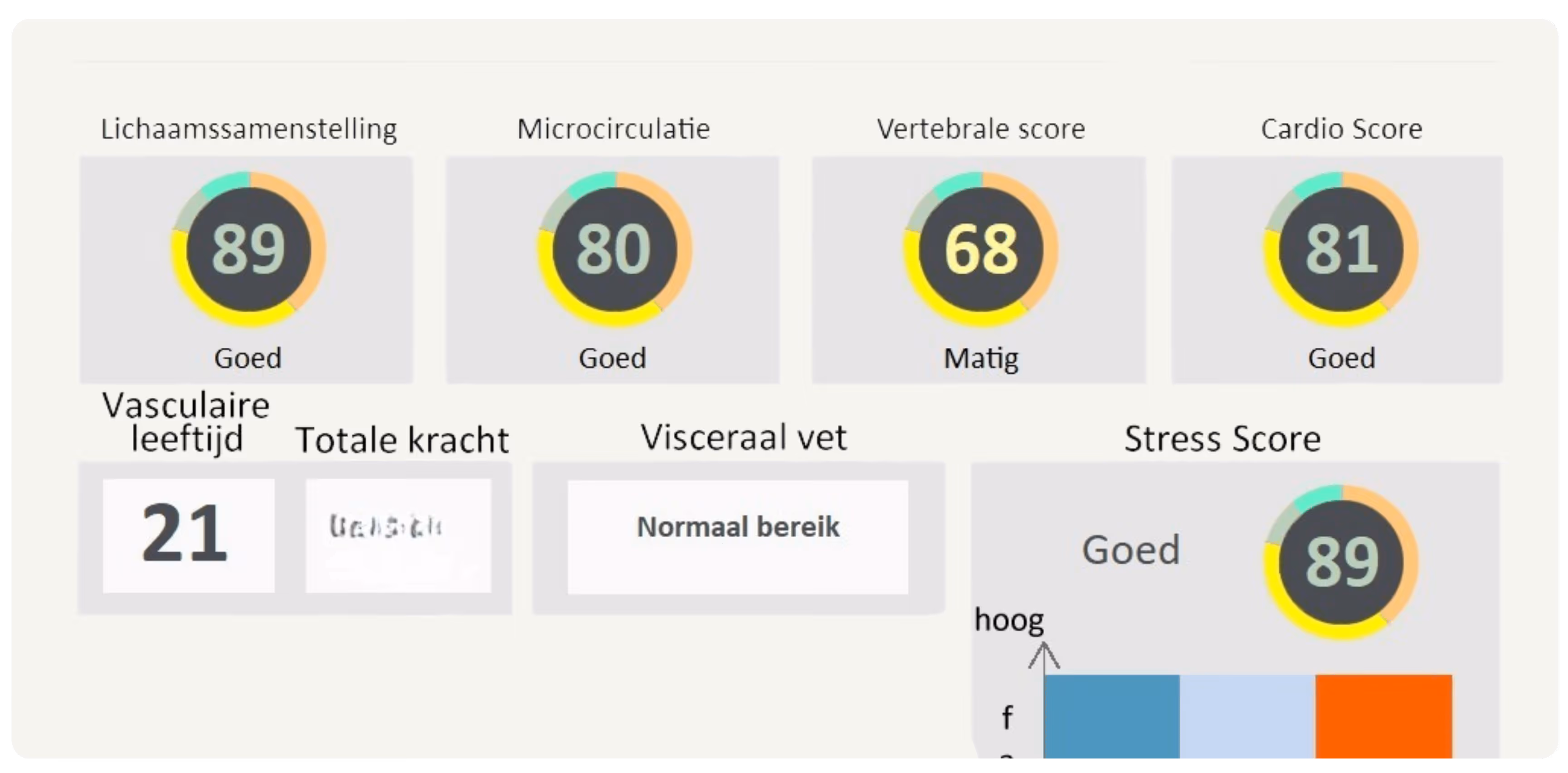 Multiscan rapport met scores: Lichaam 89 goed, Microcirculatie 80 goed, Vertebraal 68 matig, Cardio 81 goed, Viscerale vet normaal.