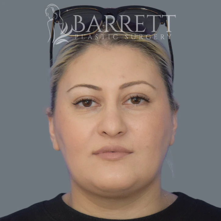 20551