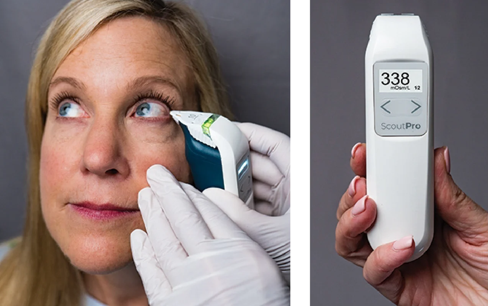 Trukera ScoutPro osmolarity system