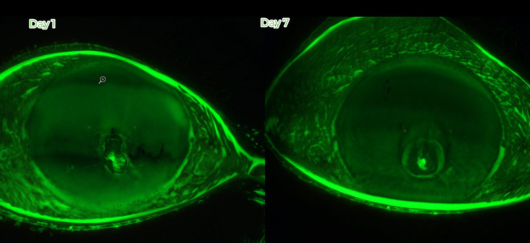 Fluorescein-stained cornea at Day 1 showing a central epithelial defect, and at Day 7 showing the defect closing
