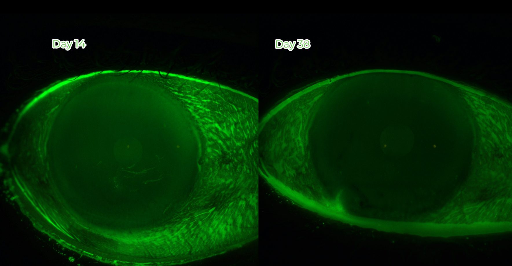 Fluorescein-stained cornea at Day 14 with a smooth surface, and at Day 38 fully settled