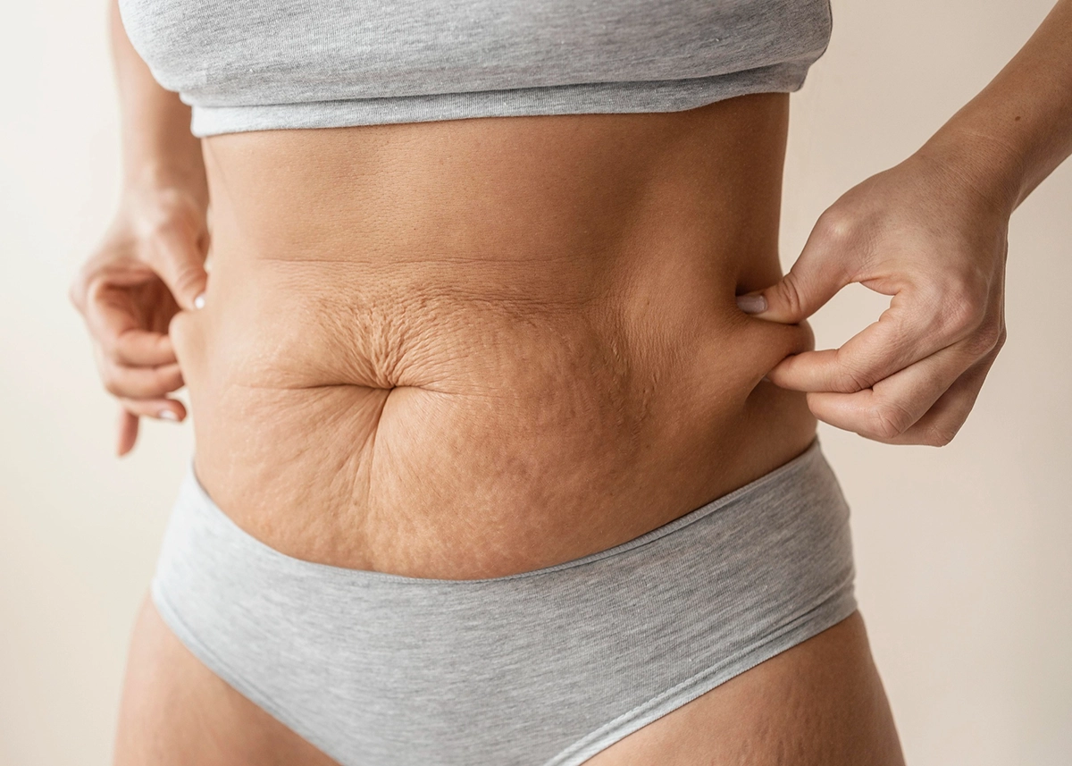 Close-up of a woman pinching loose skin on her abdomen while wearing grey underwear and top.