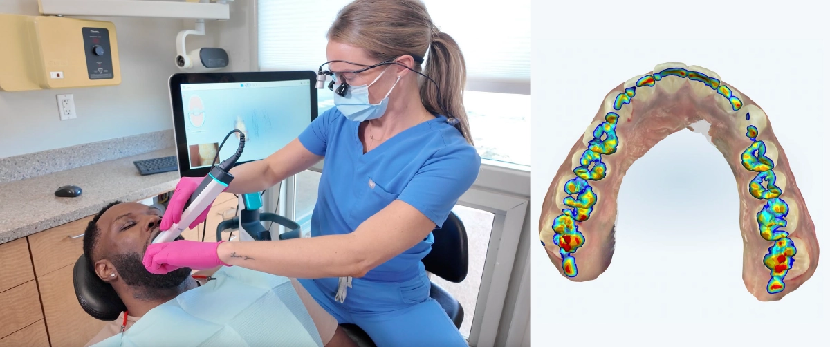 Patient receiving an iTero 3D digital dental scan at Alpers Dentistry in Scottsdale, AZ for repairing crowns accurately and evaluating bite.