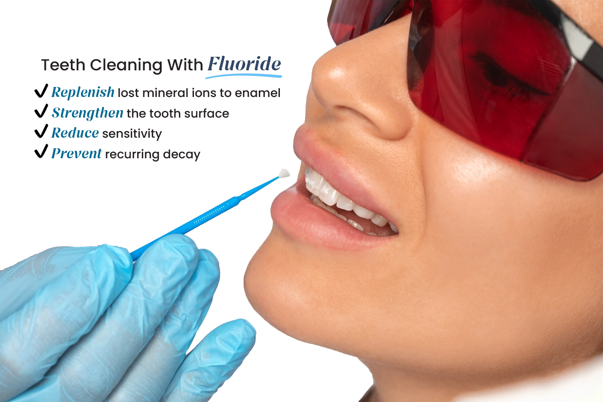 teeth cleaning with fluoride benefits: replenish lost mineral ions to enamel, strengthen tooth surface, reduce sensitivity, prevent recurring decay