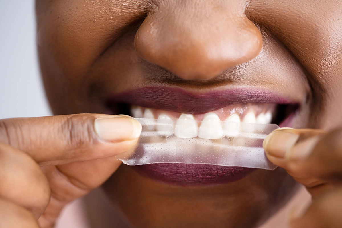 Woman applying teeth whitening strips like Crest White Strips to her teeth