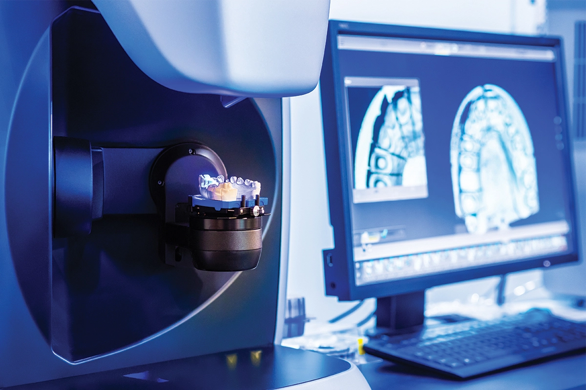 AI dental lab scanner creating digital 3D model of patient teeth for crown and veneer design at Alpers Family and Cosmetic Dentistry in Scottsdale.