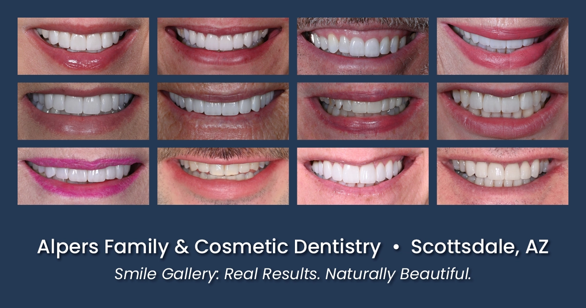 Smile… Scottsdale's Smile Makeovers: Explore Our Stunning Before and