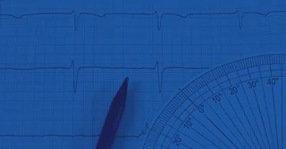 NOM-041-SCFI-1997 sobre Medidas Volumétricas Metálicas Cilíndricas [Resumen y PDF]