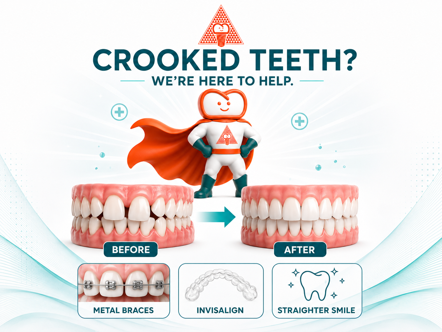 Crooked Teeth Treatment in Yishun – Braces & Invisalign