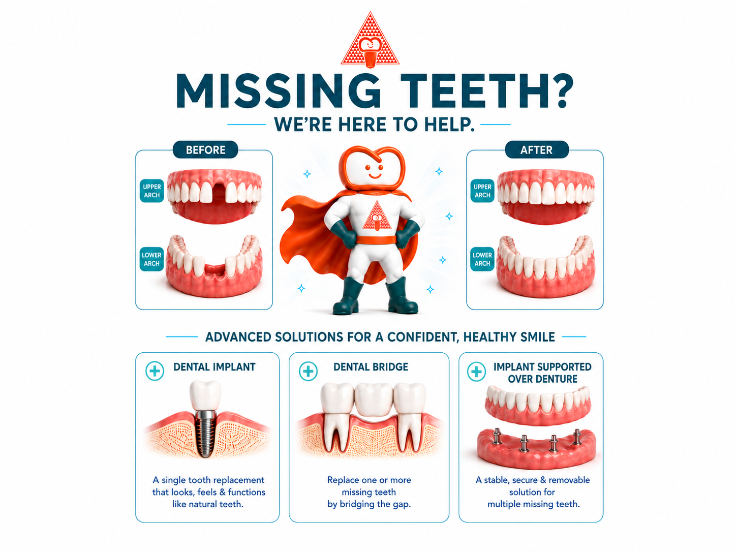 Missing Teeth Treatment in Yishun