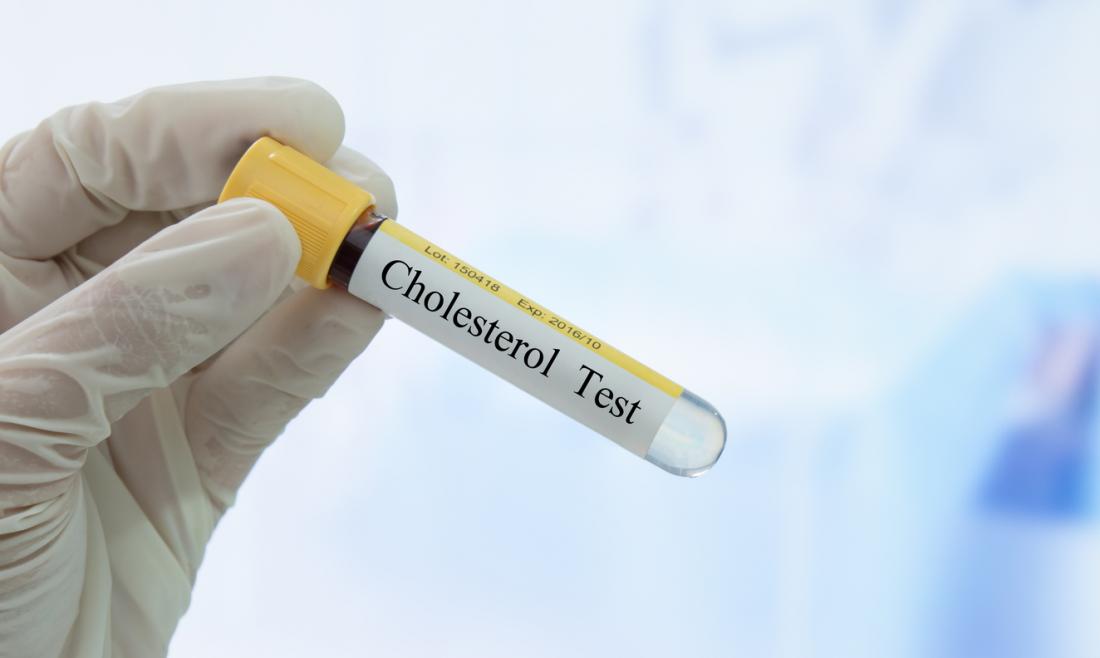 The real reason why you should be worried about high cholesterol levels