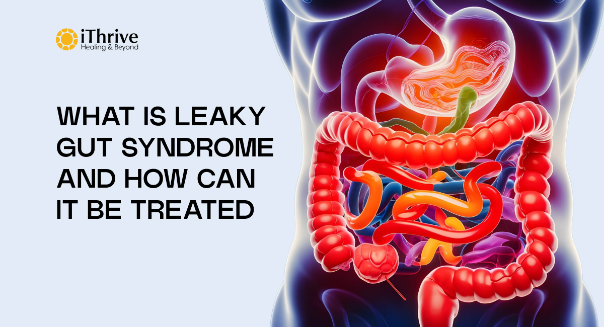 What is Leaky Gut Syndrome and How can it be treated
