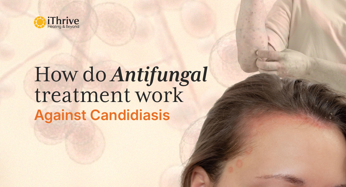 How Do Antifungal Treatment Work Against Candidiasis