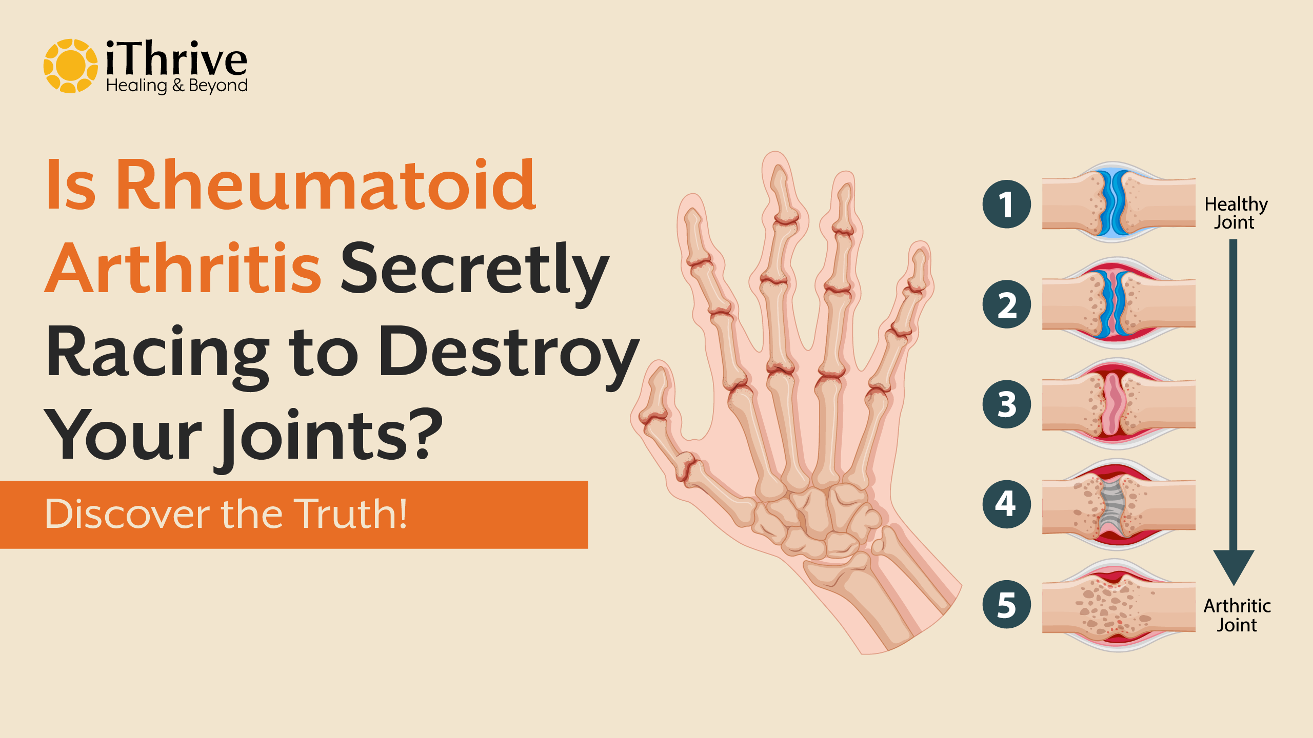 Is Rheumatoid Arthritis a Race Against Your Joints?