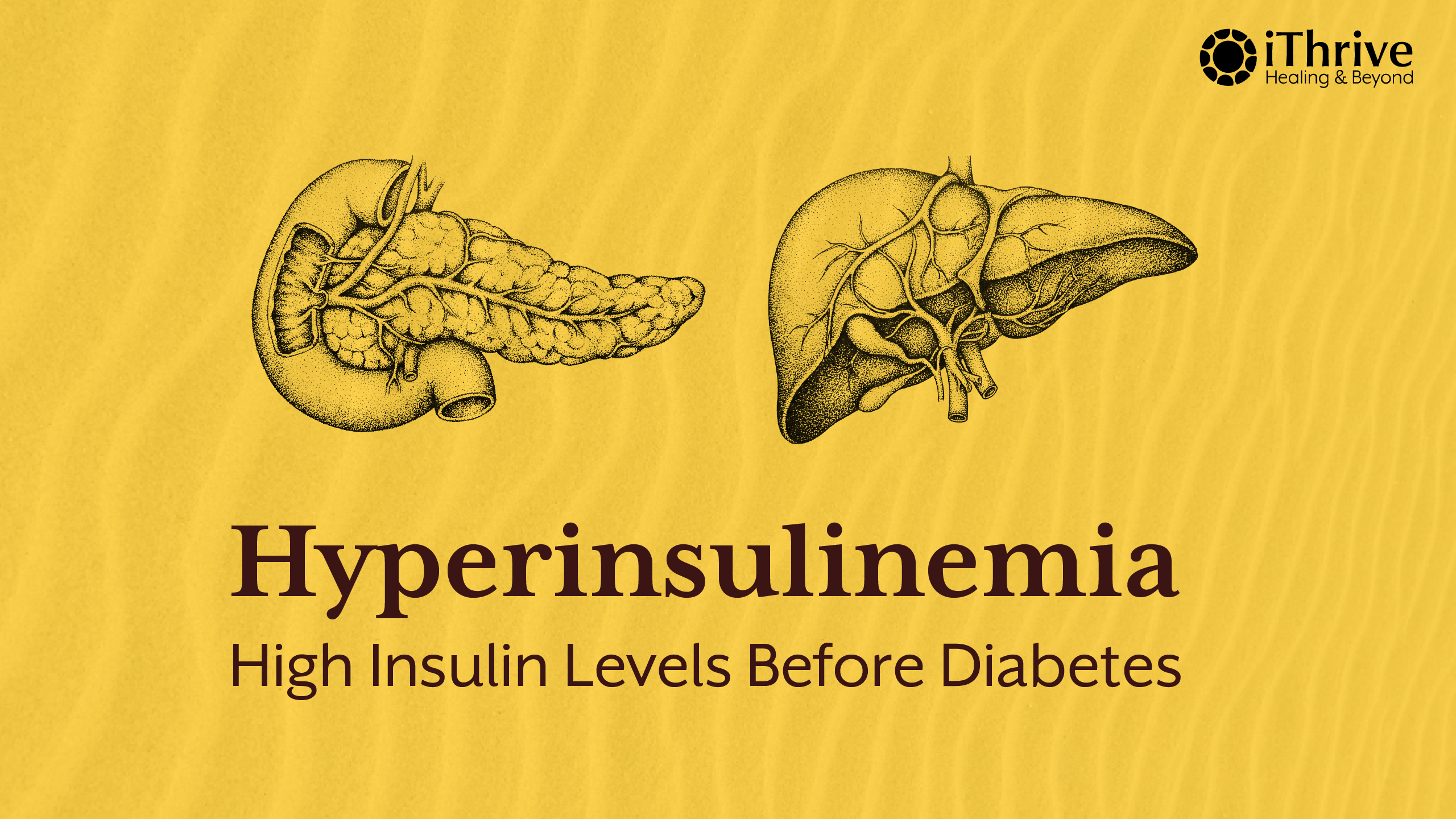 Hyperinsulinemia: The Silent Condition Your Doctor Isn’t Testing For