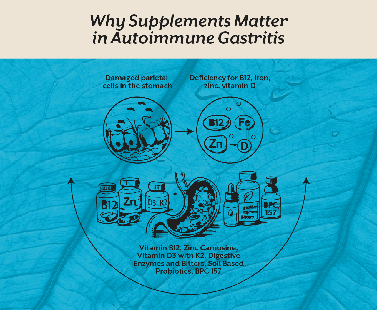 Why Supplements Matter in Autoimmune Gastritis