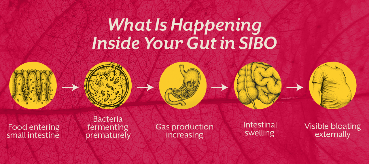 What Is Happening Inside Your Gut in SIBO