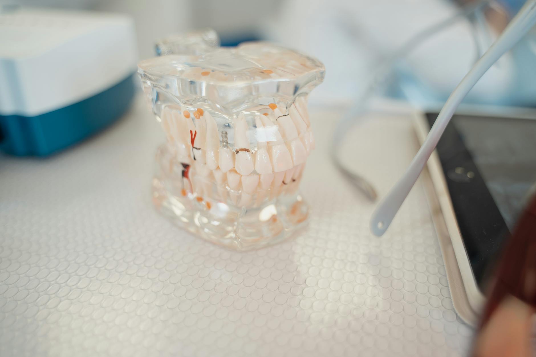 dental photography showing dental implant questions, with modern dental equipment, soft