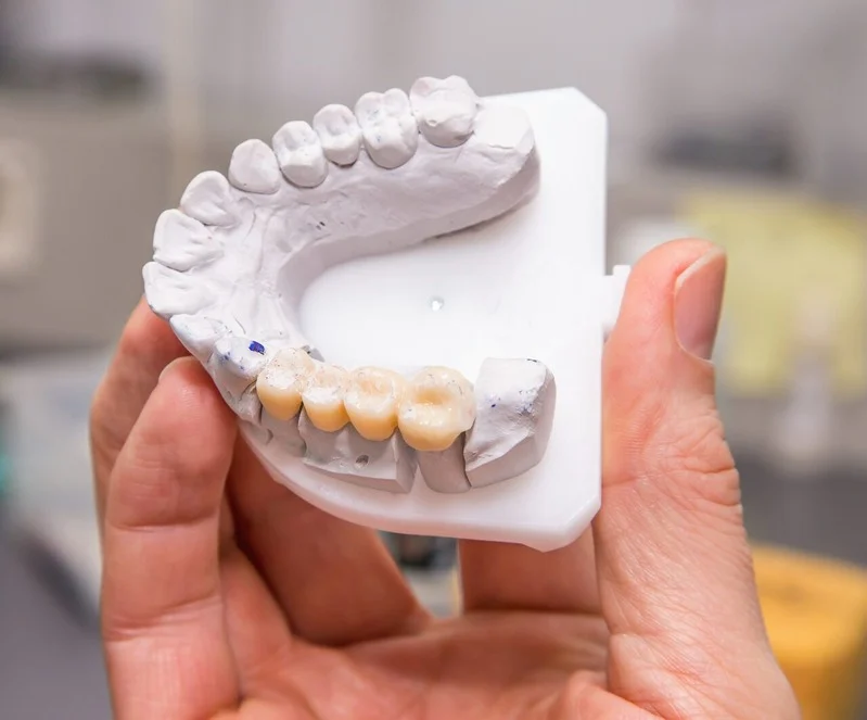 doctor holding dental prosthetics