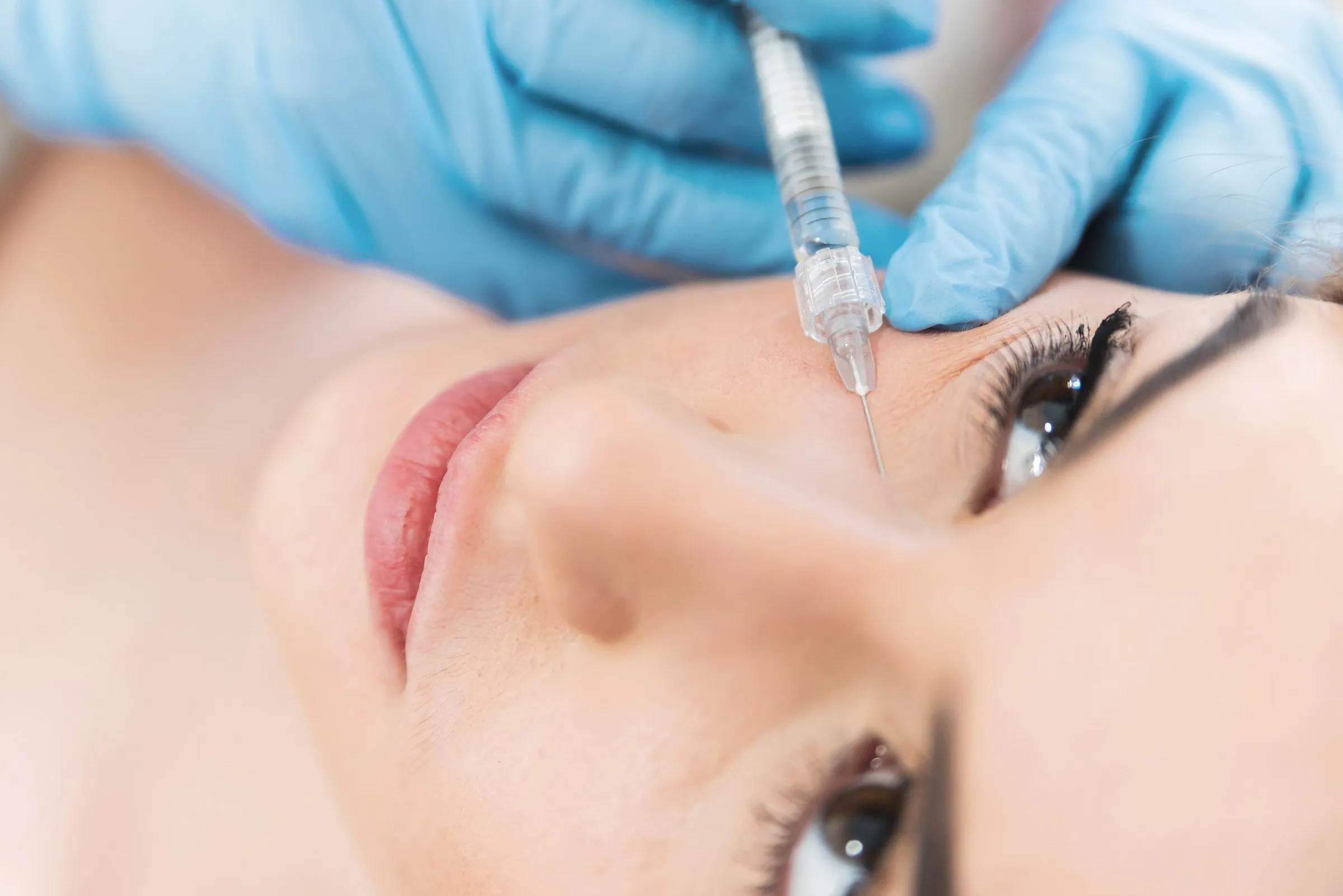 tear trough filler 