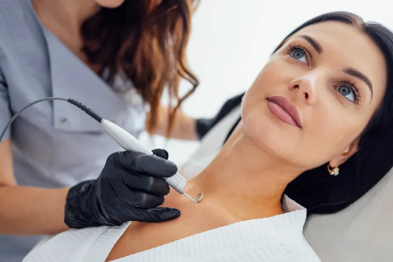 laser scar removal treatment with new technology