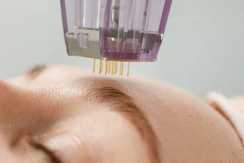 scarring treatments