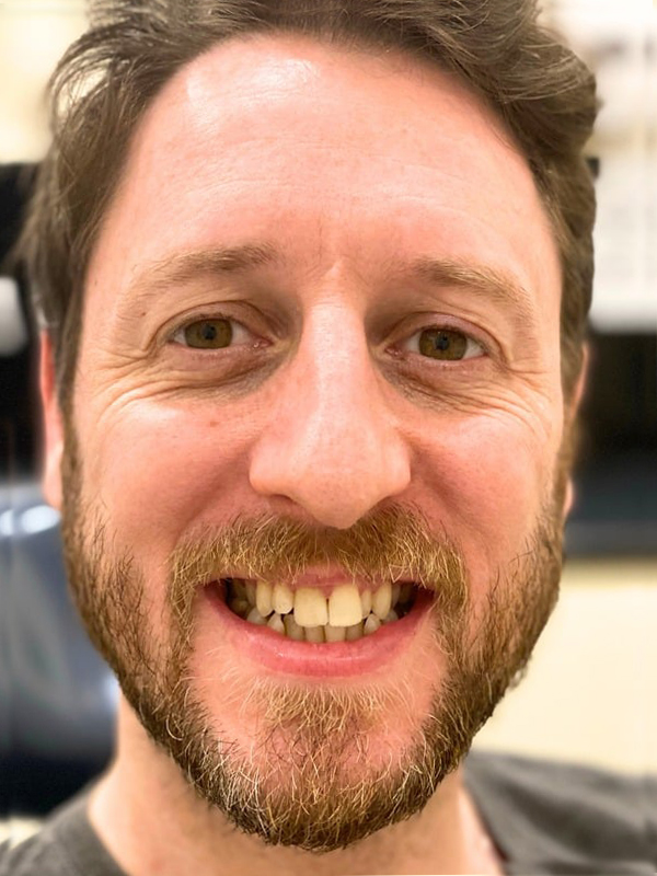 Before Treatment