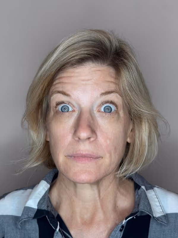 Before Treatment