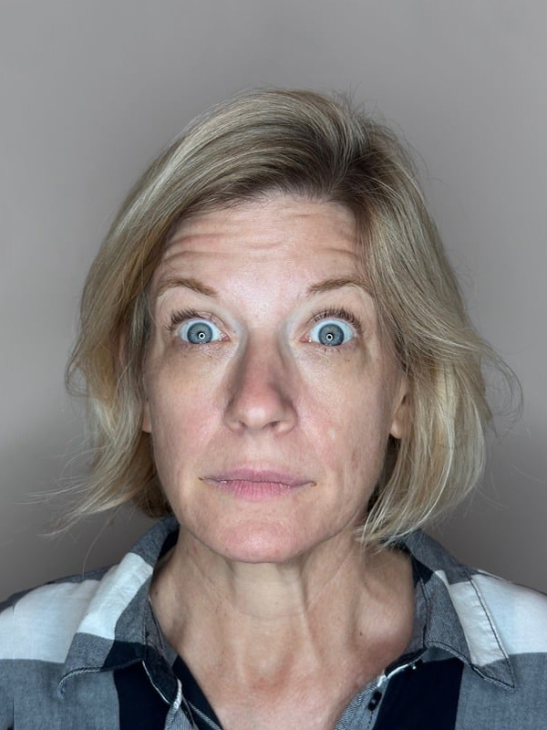 Before Treatment
