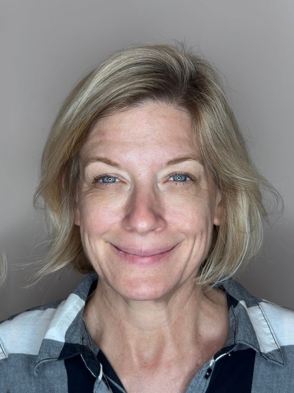 Before Treatment