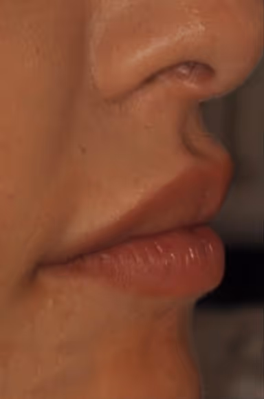 After Treatment
