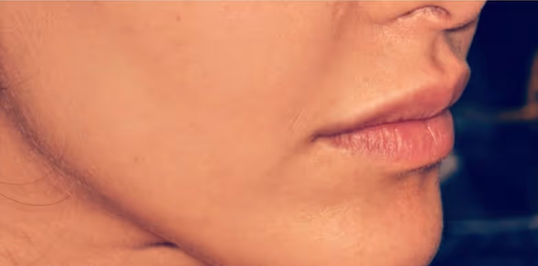 Before Treatment