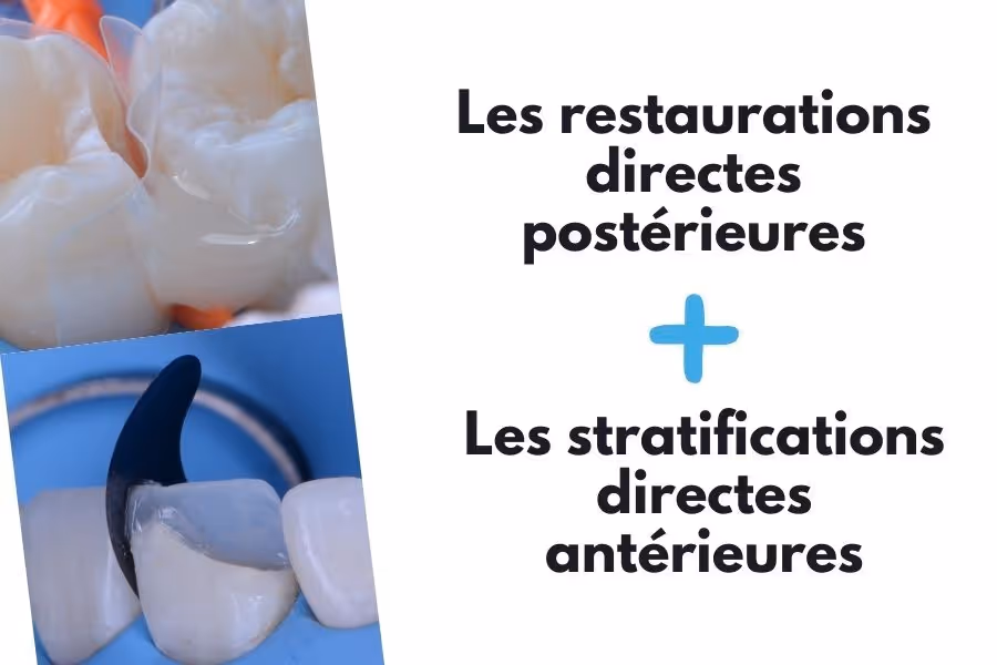 Pack DPC Restaurations directes
