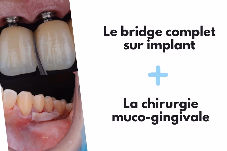 Pack DPC Chirurgie orale