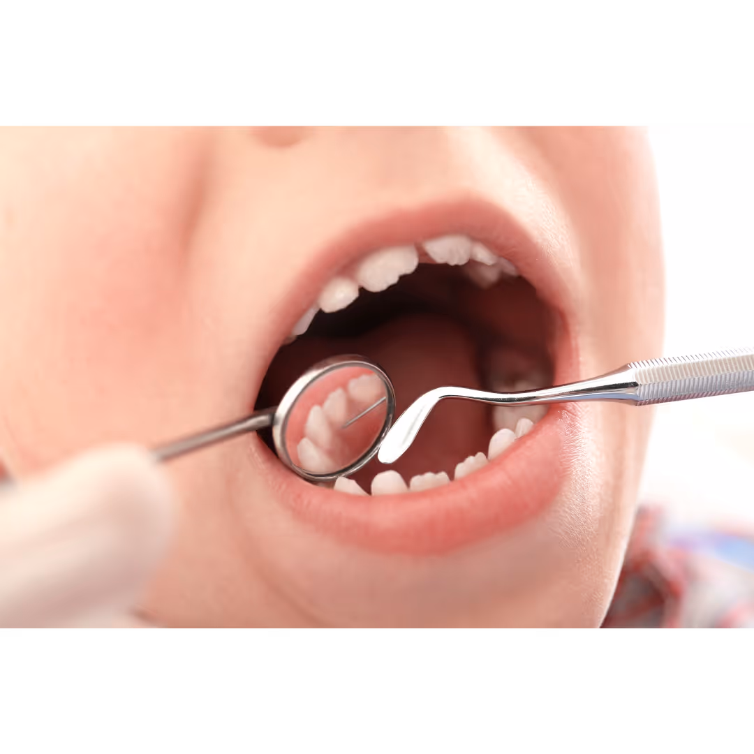 Approche clinique et traitement en pédodontie : soins dentaires spécifiques aux jeunes patients