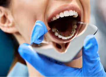 dentiste réeducation linguale