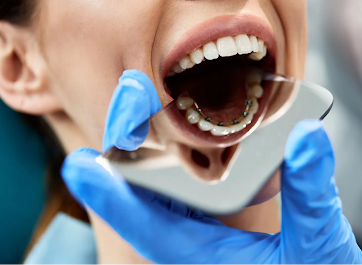 dentiste réeducation linguale