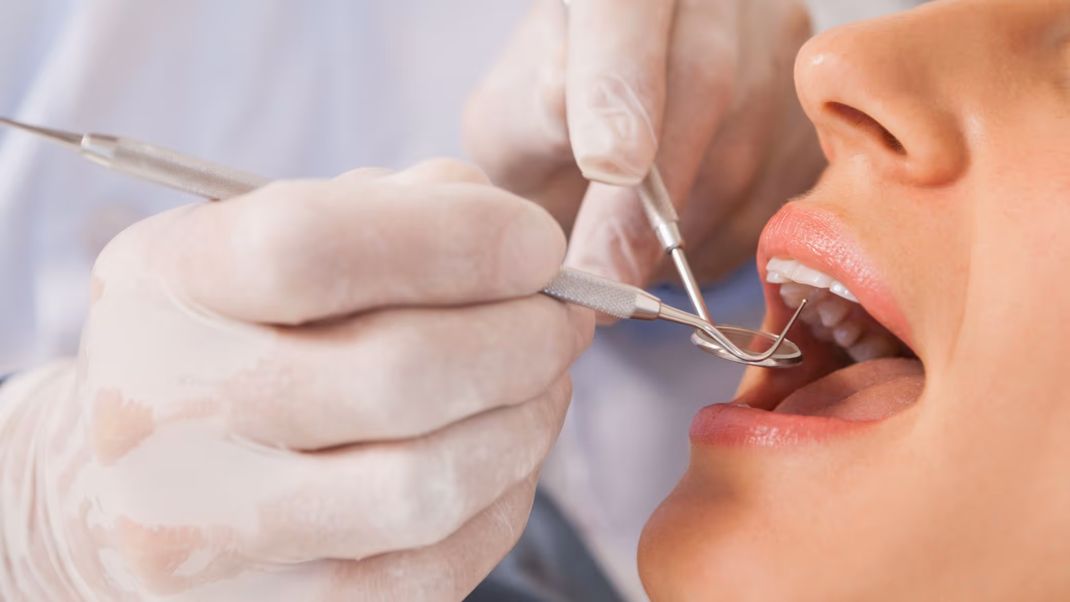 désobturation endodontique
