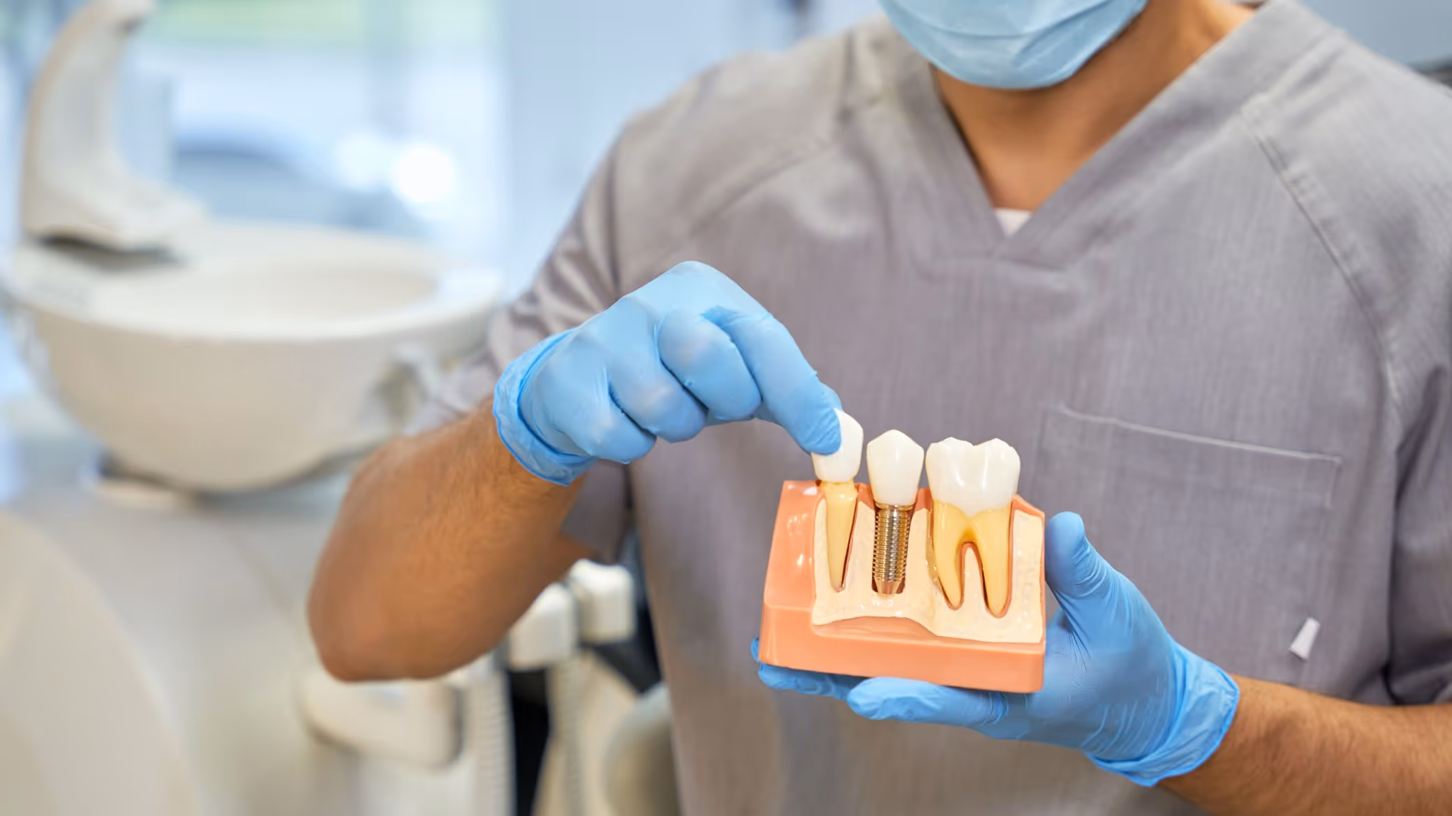 Implant dentaire : inconvénients, risques et précautions à connaître