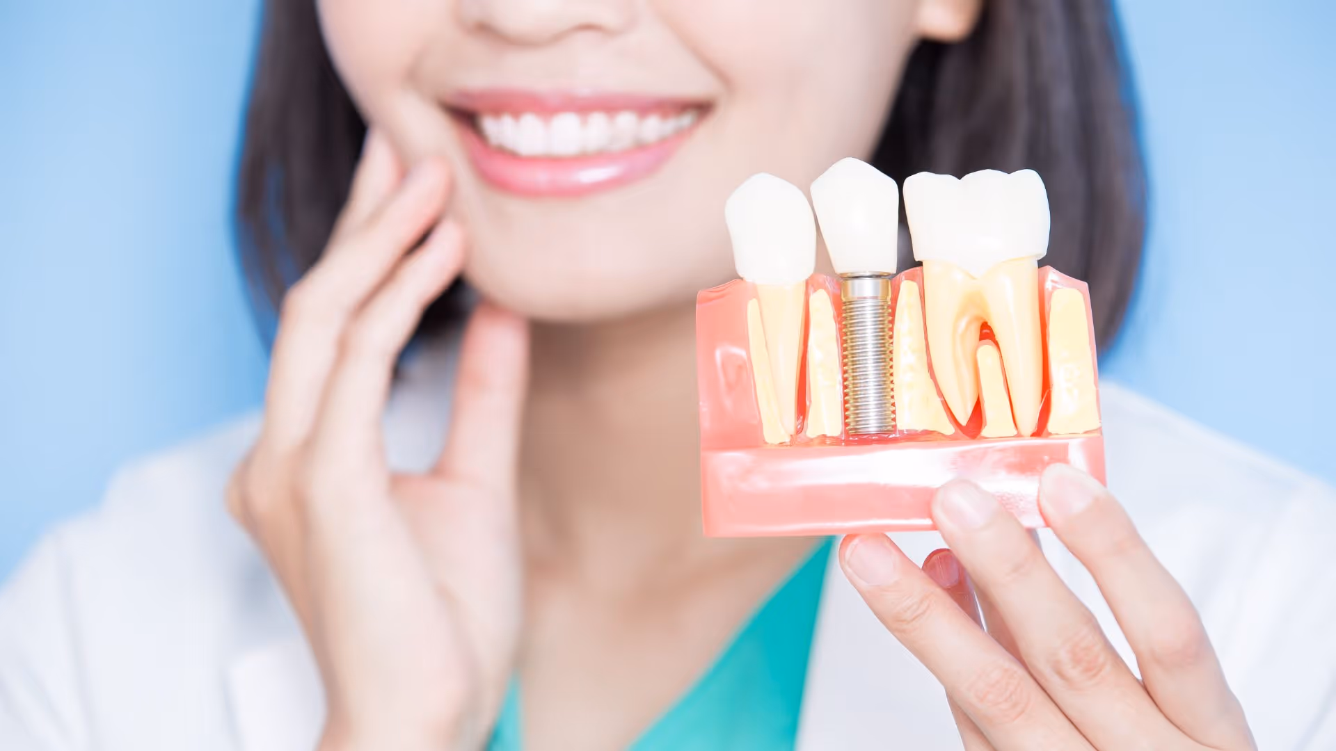 Implant dentaire vs prothèse : que choisir selon votre cas ?