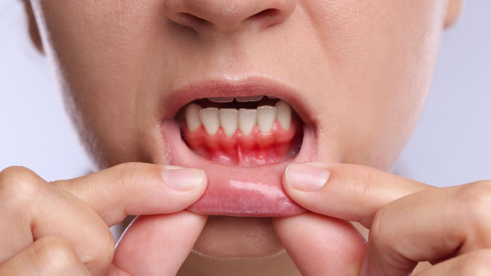 Saignement des gencives : causes, signes d'alerte et solutions