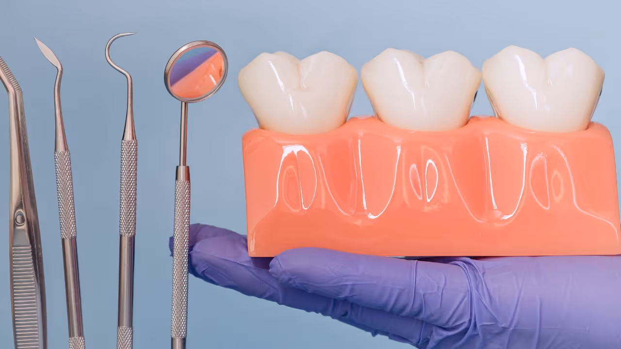 Déchaussement des dents : causes, symptômes et traitements