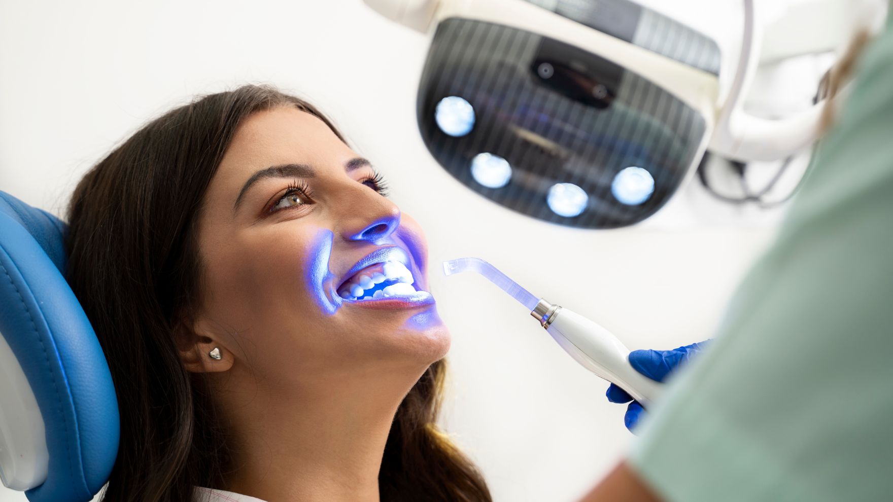 Blanchir une dent dévitalisée : le blanchiment interne expliqué