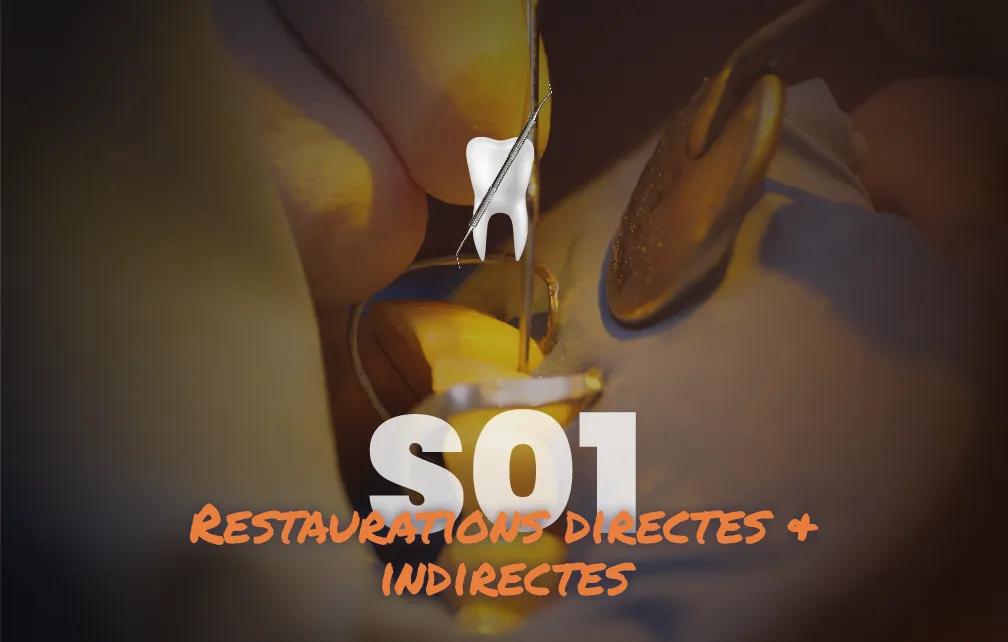 Restaurations directes & indirectes - Saison 1