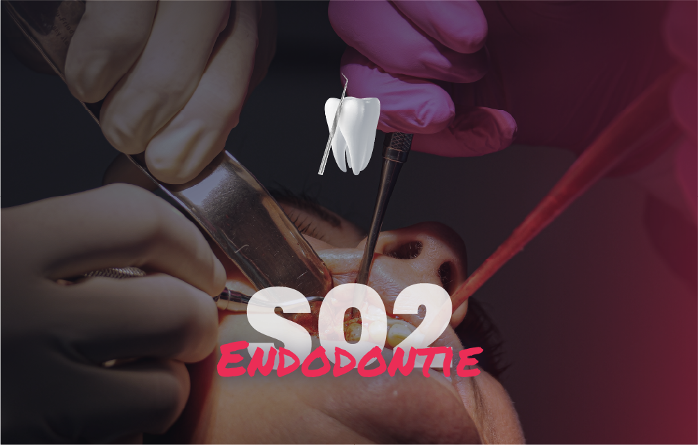 Endodontie - Saison 2